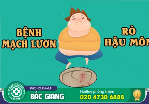Bệnh mạch lươn hậu môn - Nguyên và cách điều trị đúng