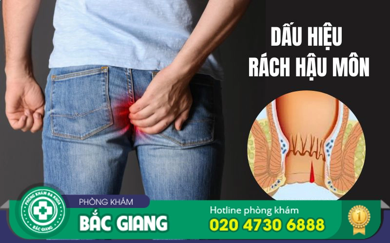 dấu hiệu rách hậu môn 